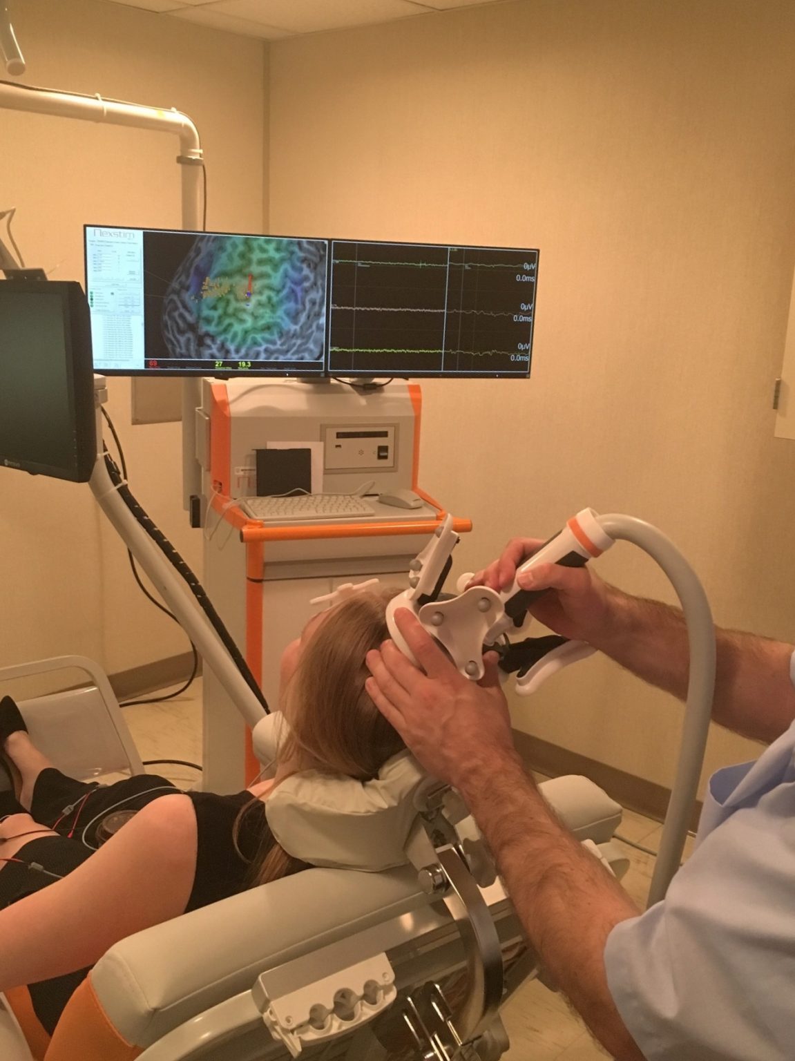 Brain Stimulation For Epilepsy Epilepsy Foundation Of Minnesota